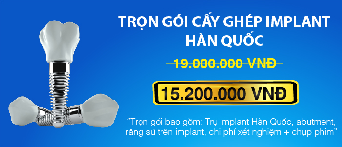 Khuyến mãi cấy ghép implant hàn quốc
