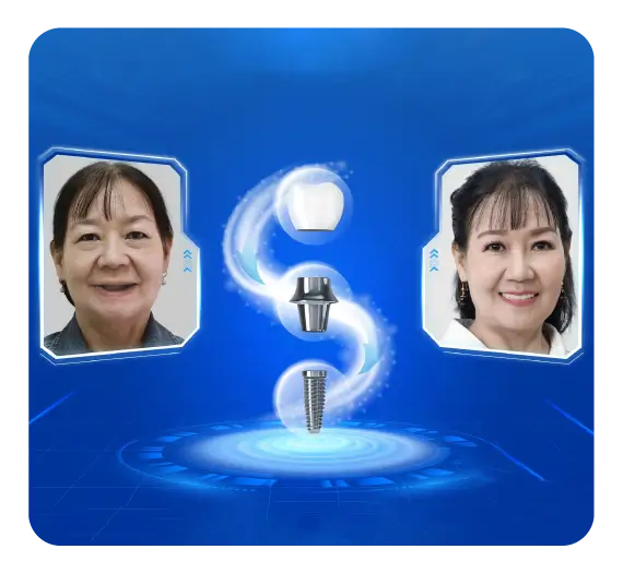 services-implant-tuc-thi