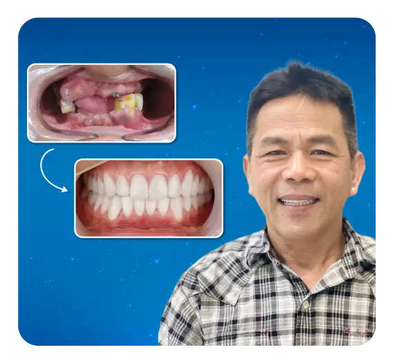 services-implan-2-ham