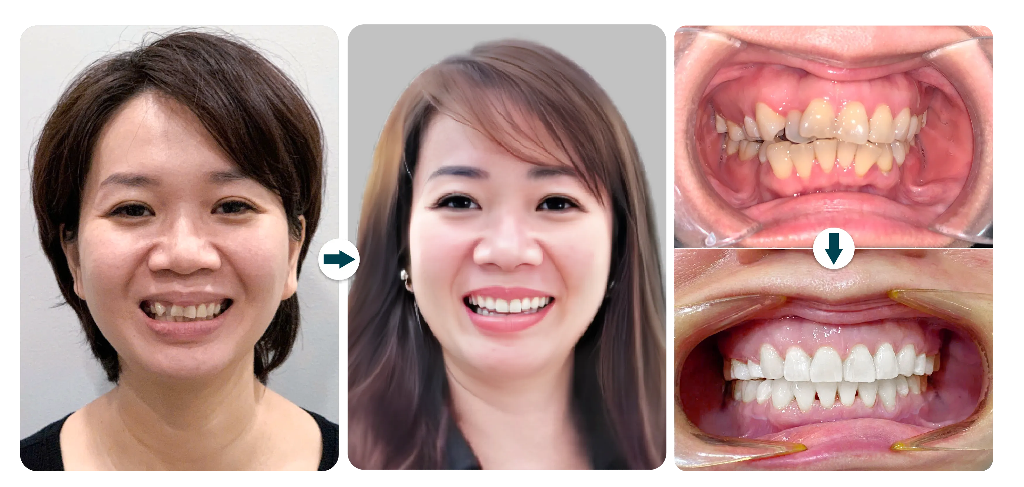 ngoc-tram-nieng-rang