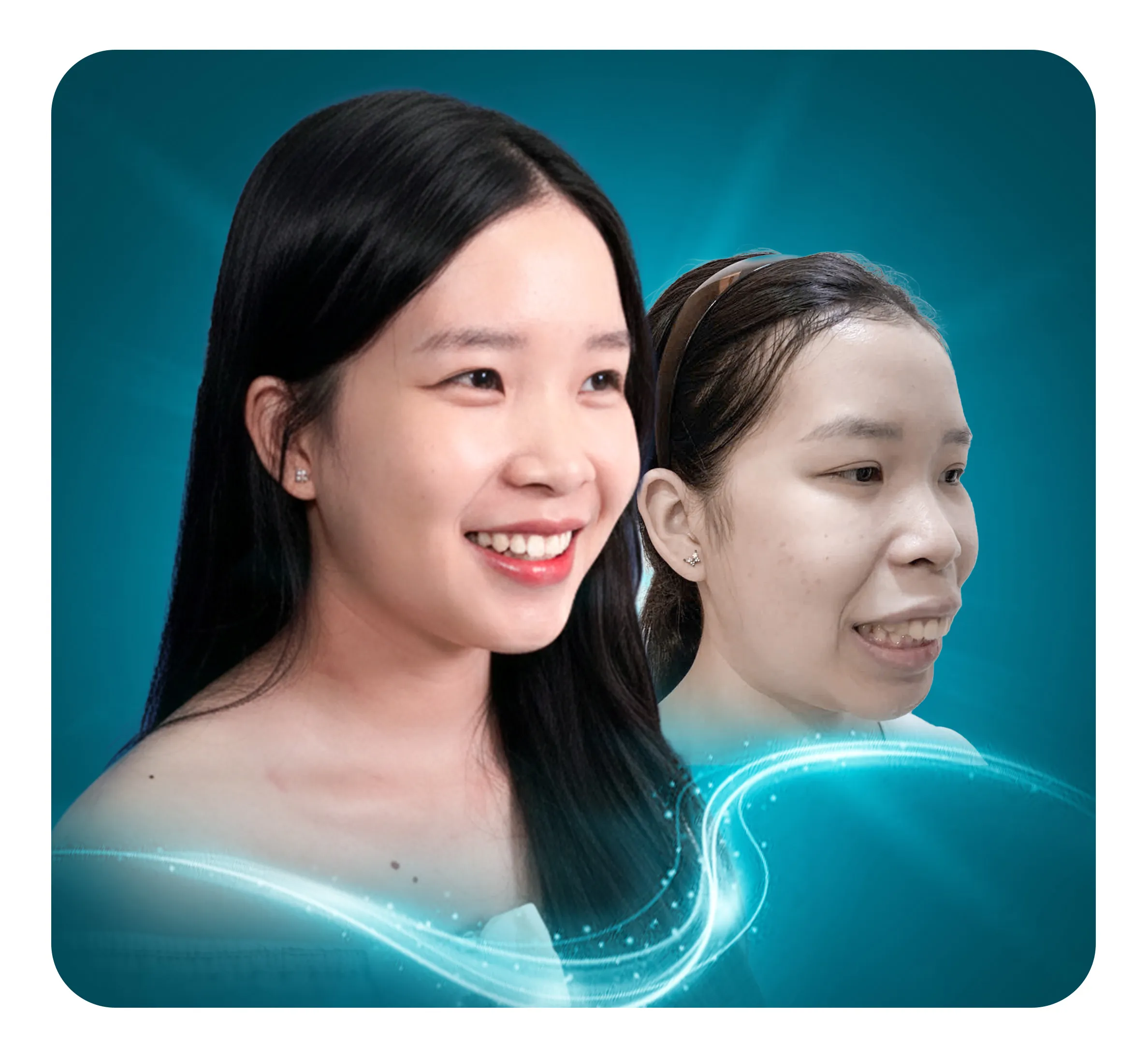 services-het-ho-vinh-vien