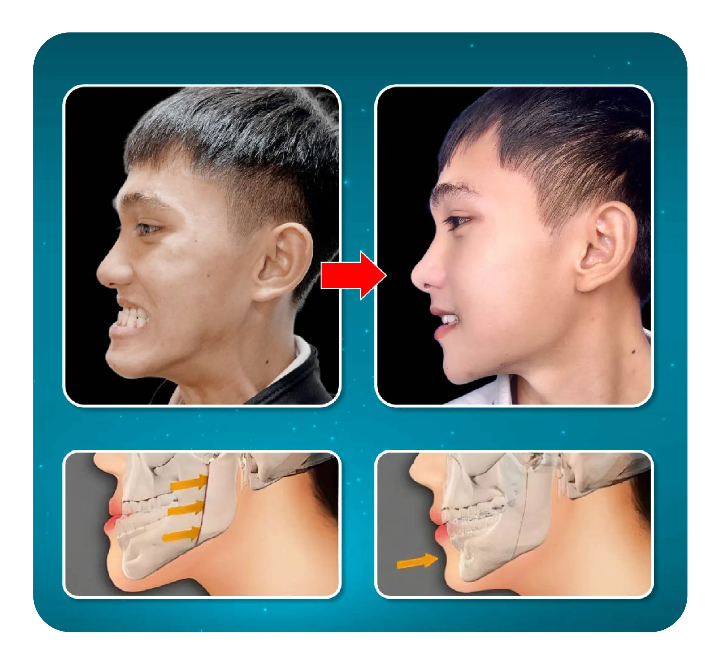 services-phau-thuat-ham-mom