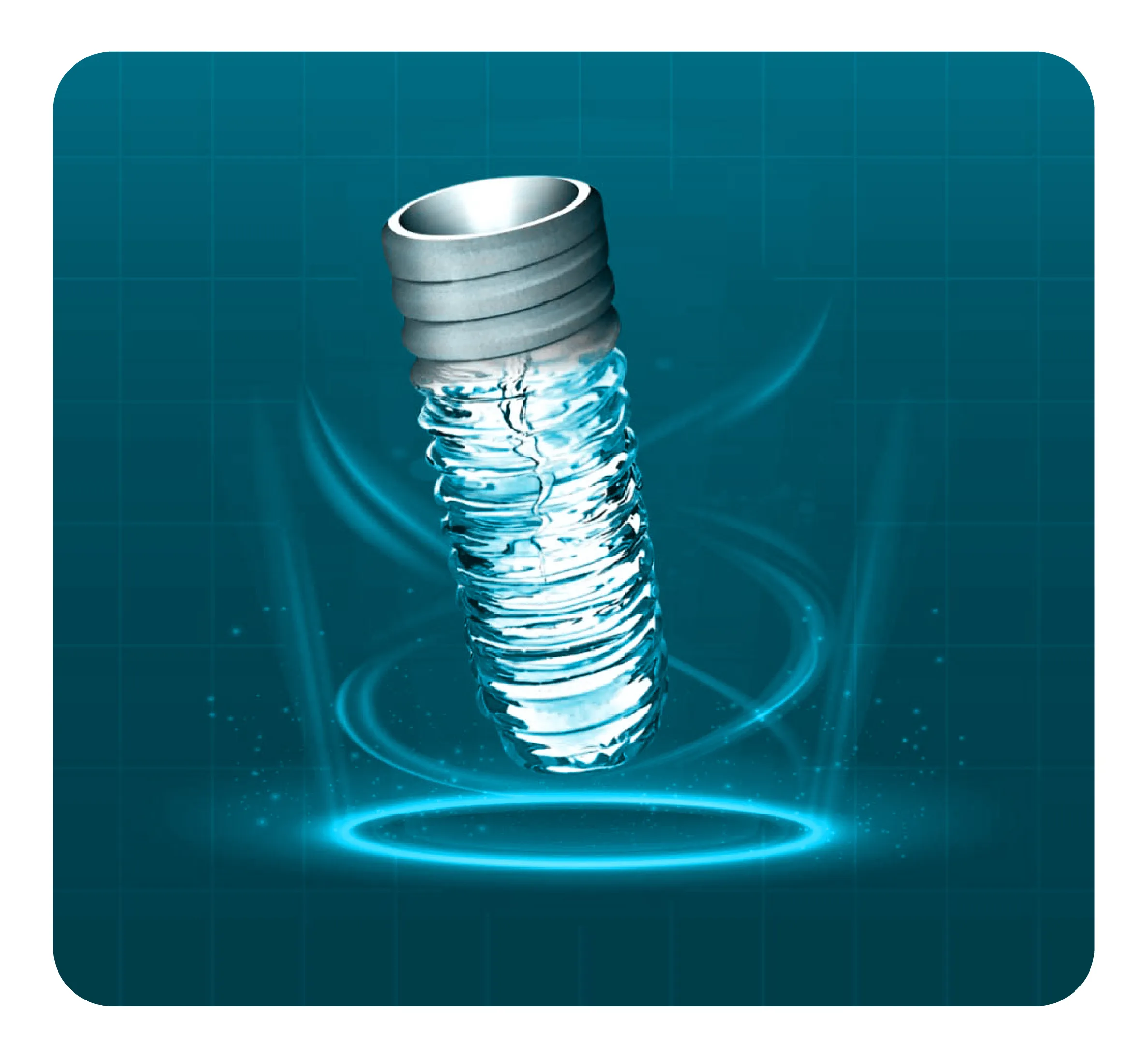 services-impant-nuoc