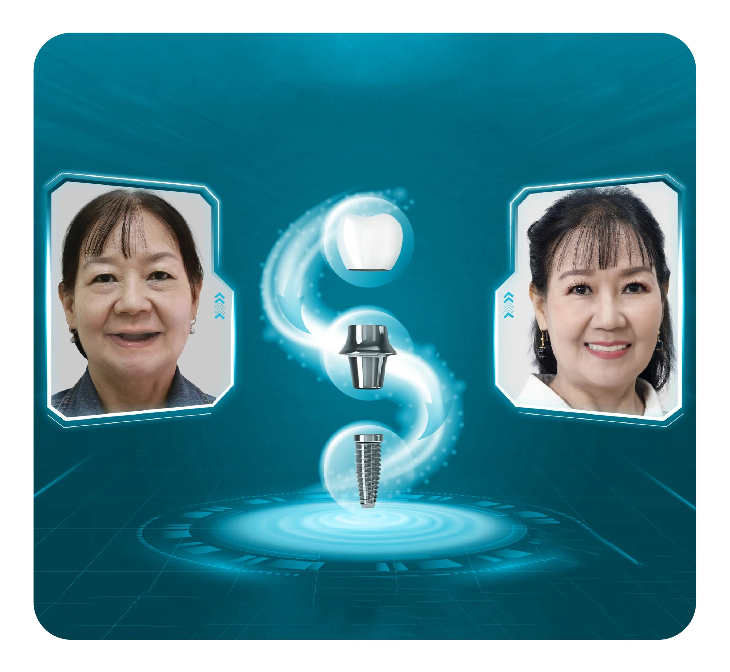 services-implant-tuc-thi