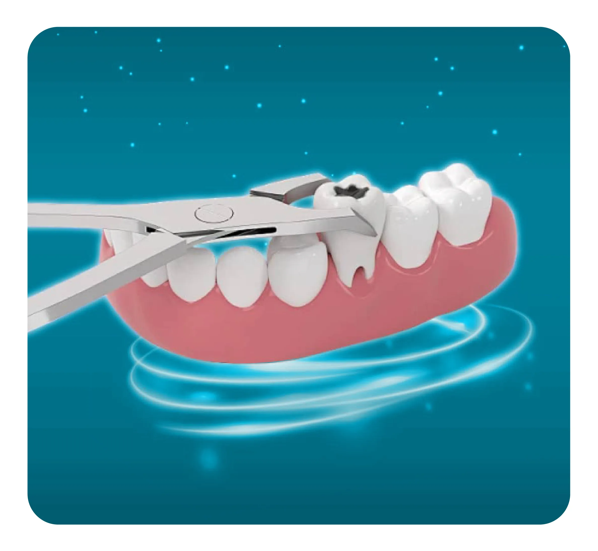 services_nho-rang-cong-nghe-hien-dai