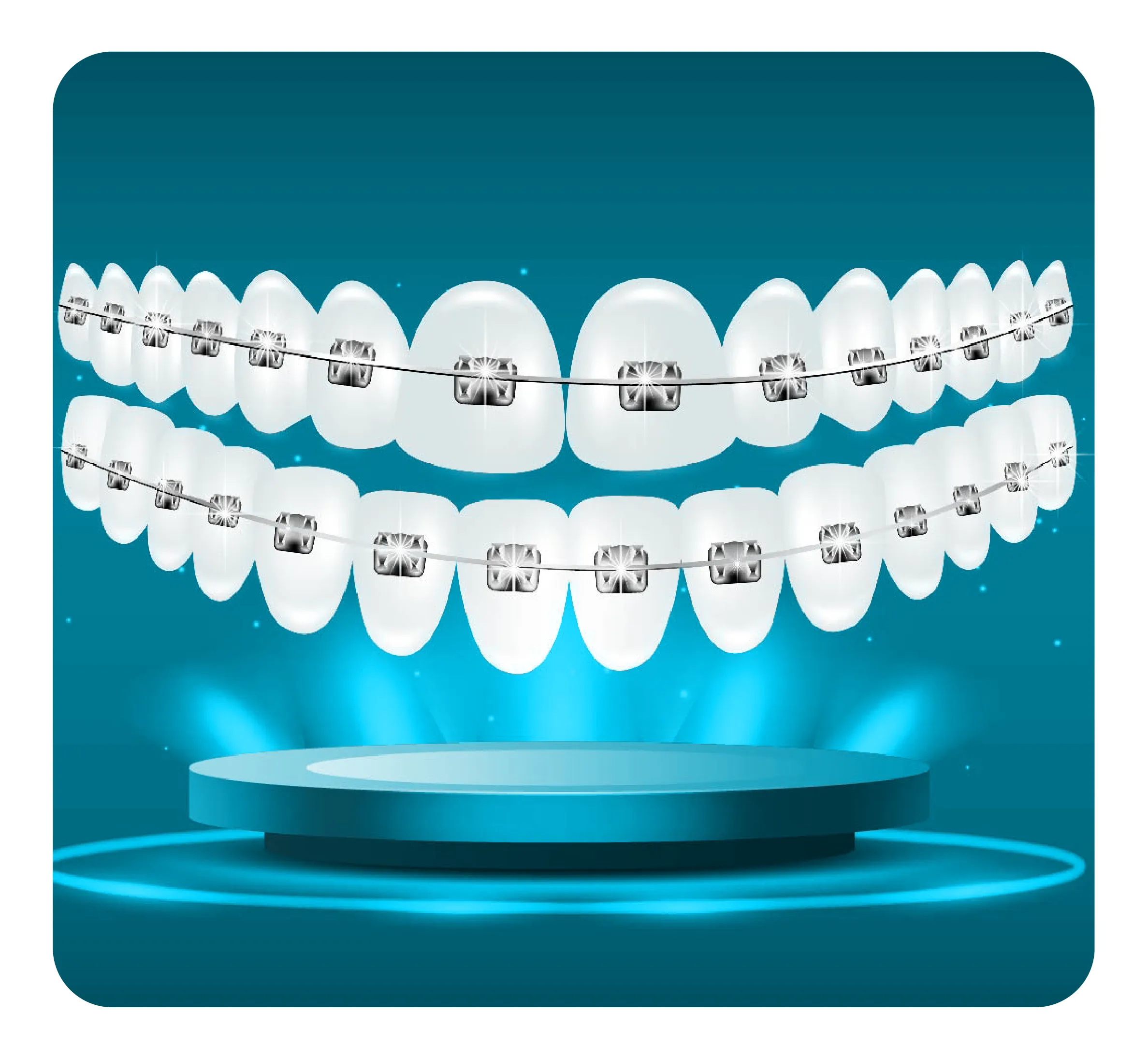 services_nieng_rang_tra_gop