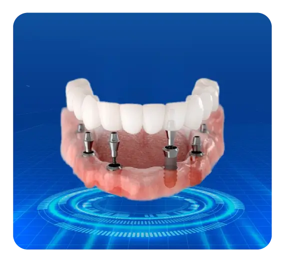 services-implan-toan-ham