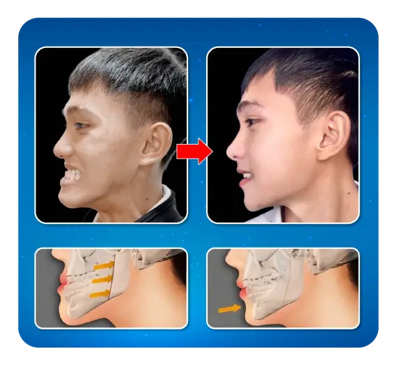 services-phau-thuat-ham-mom