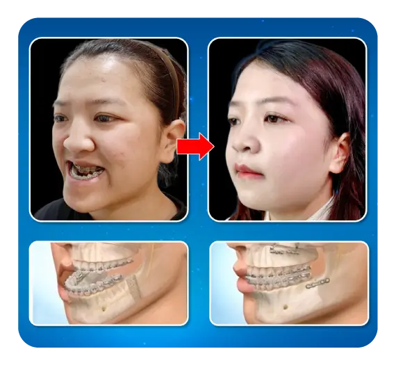 services-phau-thuat-ham-nieng-rang