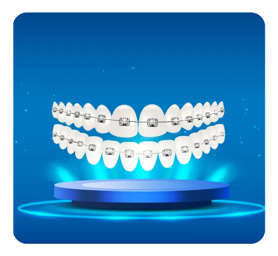 services_nieng_rang_tra_gop