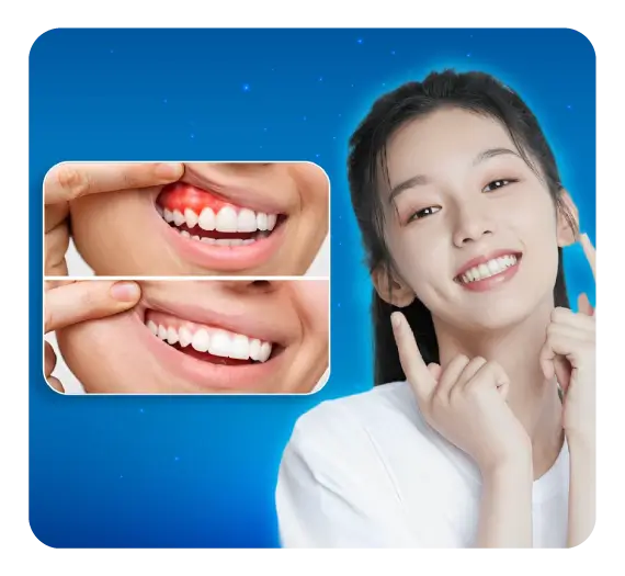 services-dieu-tri-viem-nha-chu