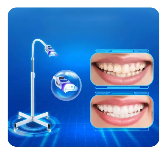 services_tong-quat-tay-trang-rang