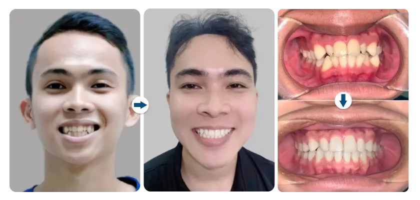facial_dentistry_4