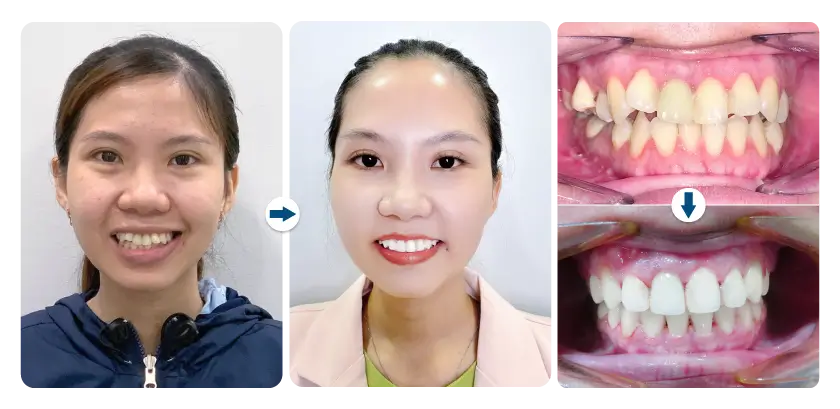 facial_dentistry_3