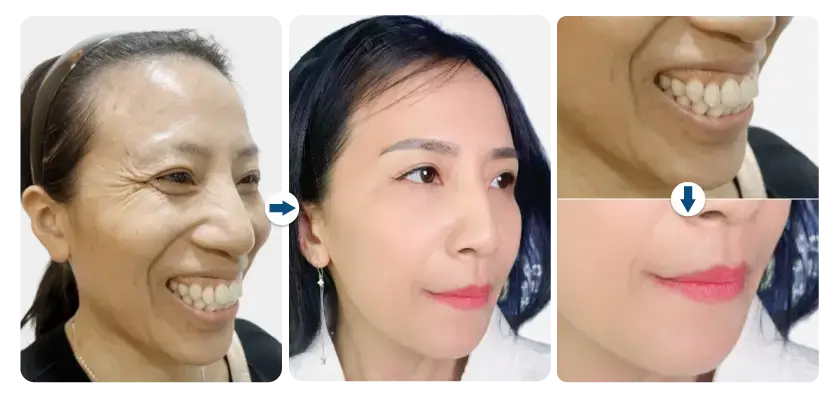 ham-mat-imag-kh-thu-trang-phau-thuat-ham-ho-chua-cuoi-ho-loi