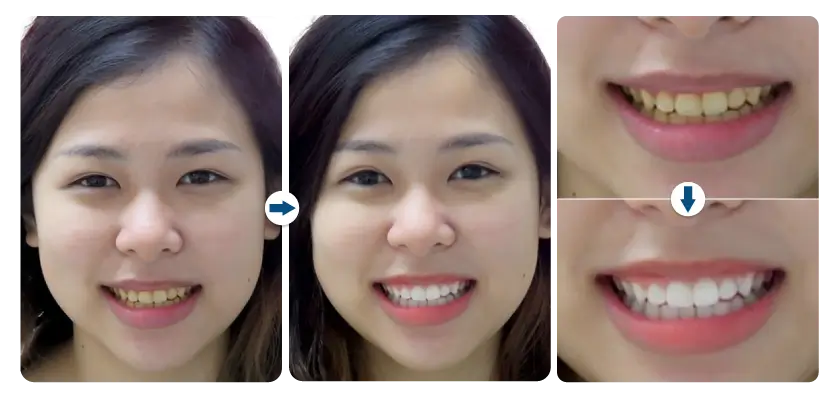 bao-ngoc-tay-trang-rang