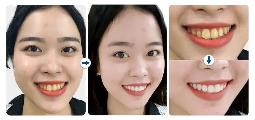 kim-uyen-tay-trang-rang