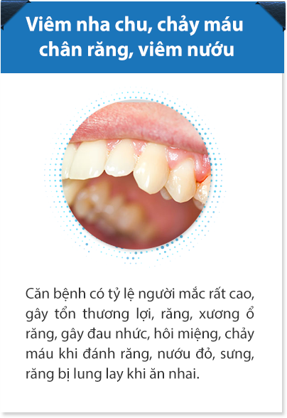 Hình ảnh bệnh lý răng miệng