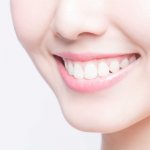 Những phương pháp tẩy trắng răng an toàn – Nha Khoa JW