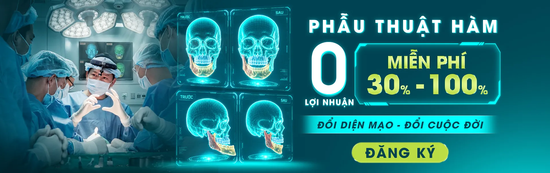Hình ảnh banner phẩu thuật hàm 0 đồng tại bệnh viện JW