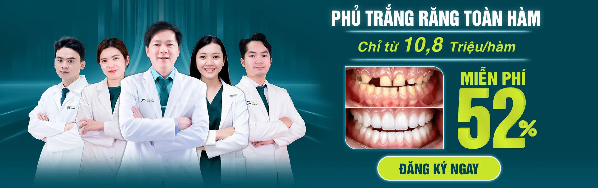 Phủ trắng răng toàn hàm chỉ từ 10,8 triệu