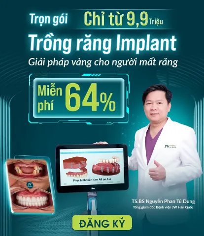 Banner Trồng răng Implant trọn gói chỉ từ 9,9 triệu