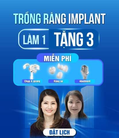 chinh-sach-dich-vu-trong-rang-implant-tai-khoa-rang-ham-mat-jw