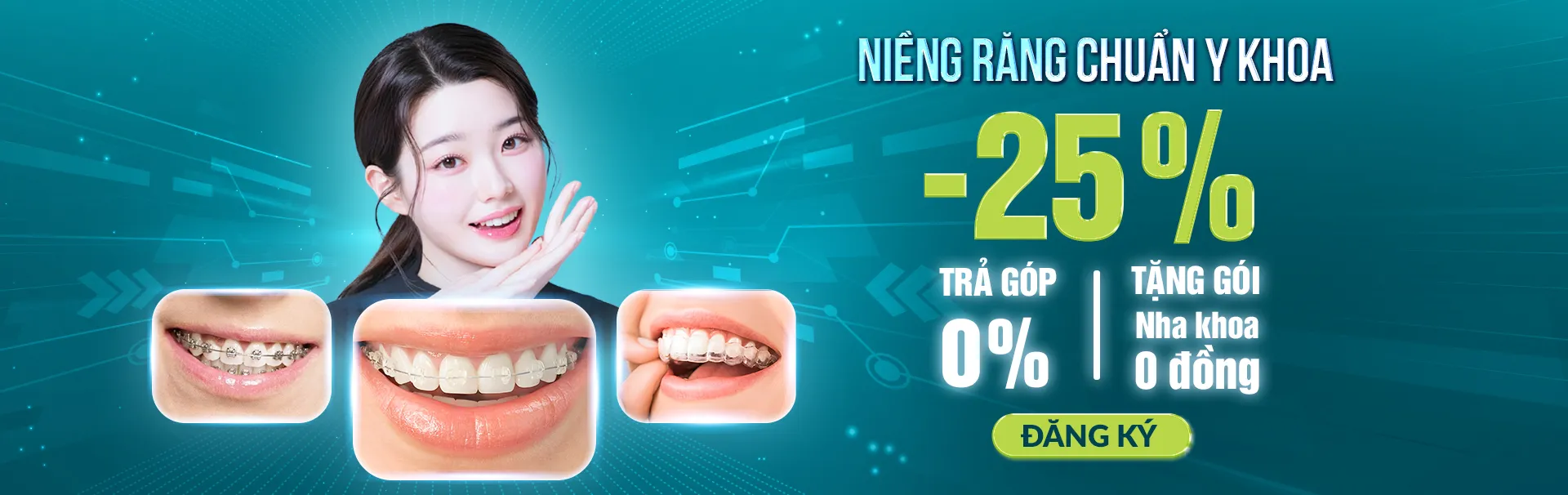 nieng-rang-smart-loai-nao-tot-nhat