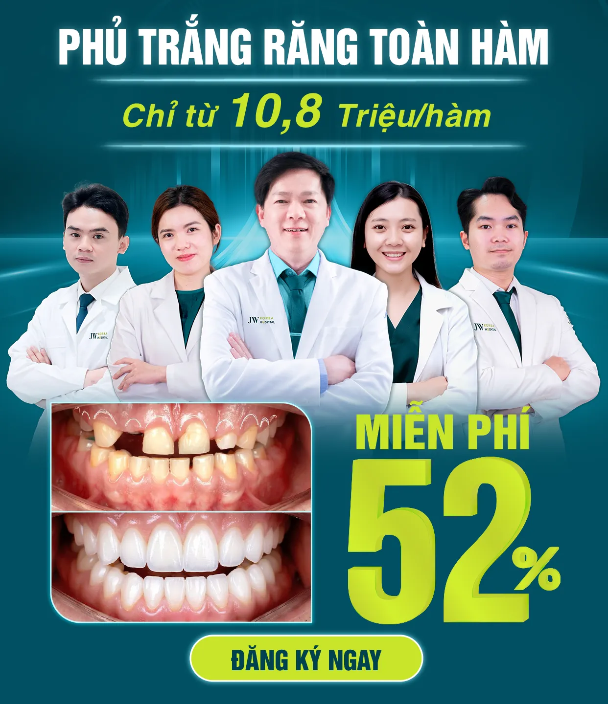 Phủ trắng răng toàn hàm chỉ từ 10,8 triệu