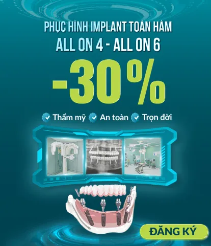 boc-rang-su-khai-niem-phan-loai-chi-phi