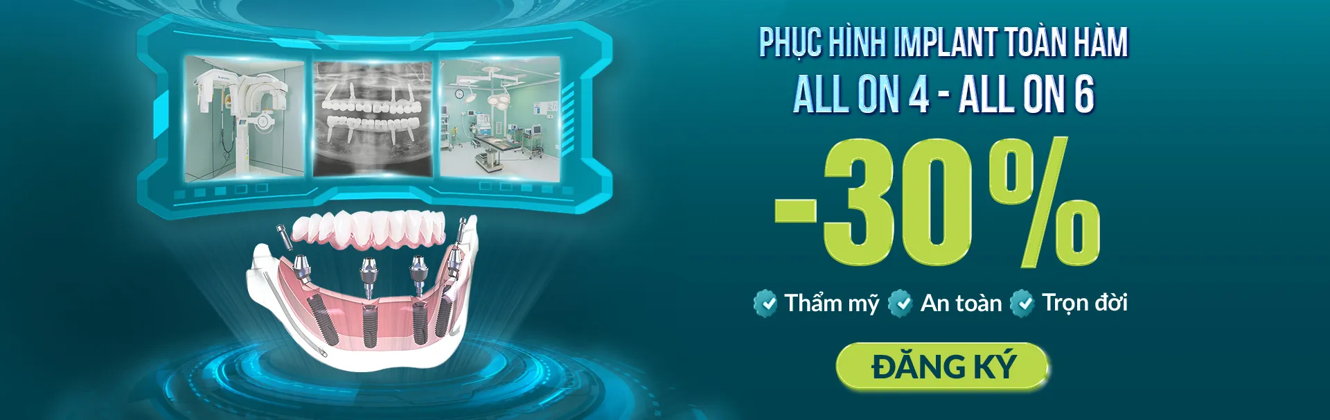 boc-rang-su-khai-niem-phan-loai-chi-phi