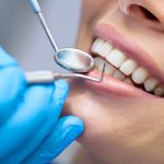 Cấy ghép răng implant giá bao nhiêu tiền