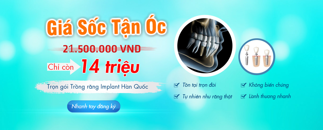 Trồng răng Implant Hàn Quốc giá Sốc trọn gói chỉ với 14 triệu