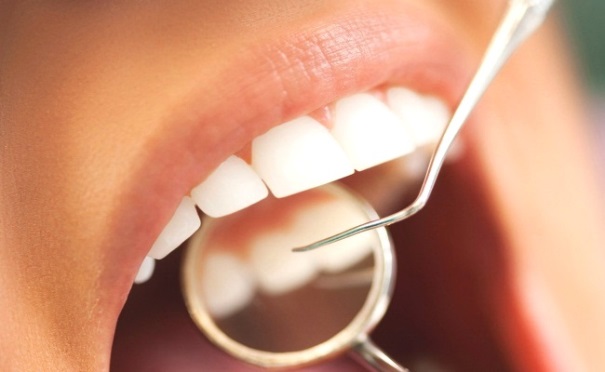 Loại bỏ cao răng hiệu quả nhanh chóng và an toàn