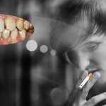Làm trắng răng cho người hút thuốc bằng cách nào?