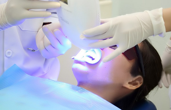 Làm trắng răng an toàn hiệu quả bằng công nghệ Laser Whitening