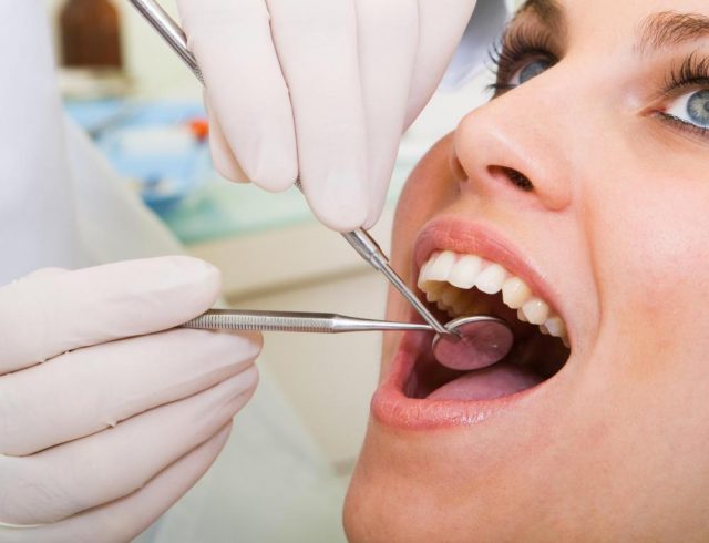 Để trám răng đem lại kết quả như ý, tay nghề bác sĩ là yếu tố cần thiết và quan trọng