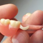 Qua đời vì tại nạn hy hữu – Một người đàn ông chết nghẹn vì hàm răng giả