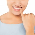 [TƯ VẤN] Lấy cao răng có phải kiêng gì không?