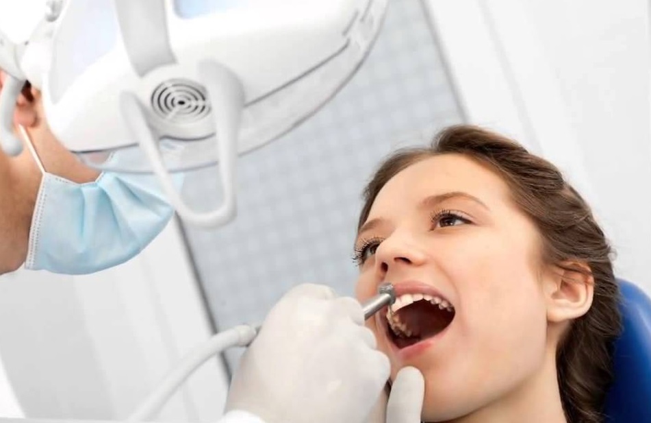 Lấy cao răng là phương pháp loại bỏ mảng bám trên răng hiệu quả