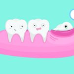 5 biểu hiện của mọc răng khôn dễ nhận biết nhất