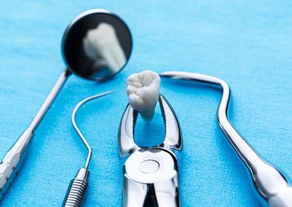 Nếu đau nhức kéo dài, bạn buộc phải đến nha khoa để bác sĩ thực hiện nhổ răng khôn 