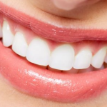 Làm răng giả giúp phục hình răng chắc chắn y như thật