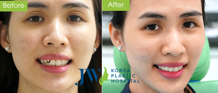 Hình ảnh khách hàng sử dụng Công nghệ Nha Khoa 4.0 JW