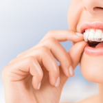 Niềng răng không mắc cài có tốt hơn niềng răng truyền thống?