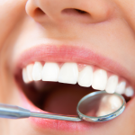 Răng sứ là gì? Bọc răng sứ có tốt không?