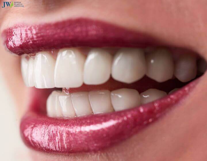 Công nghệ trồng răng implant có đau không? 3