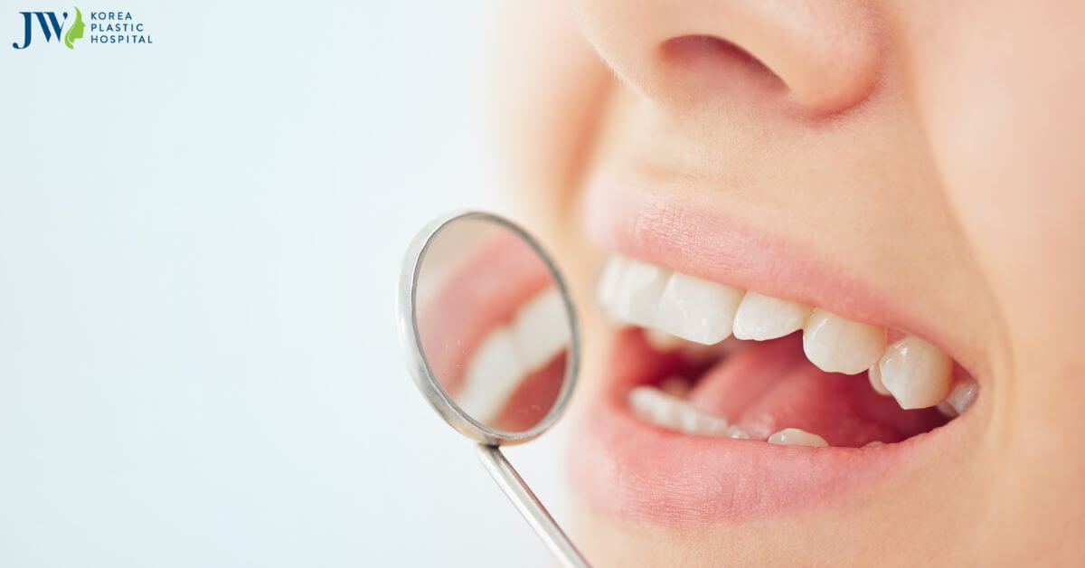 Dán sứ veneer thẩm mỹ răng có gây hôi miệng không? Thumb