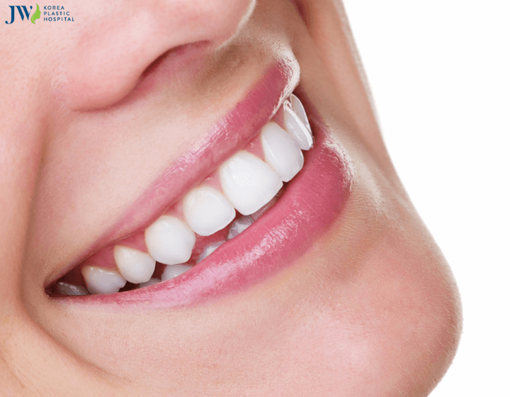 Răng sứ veneer có gây hại không? 1