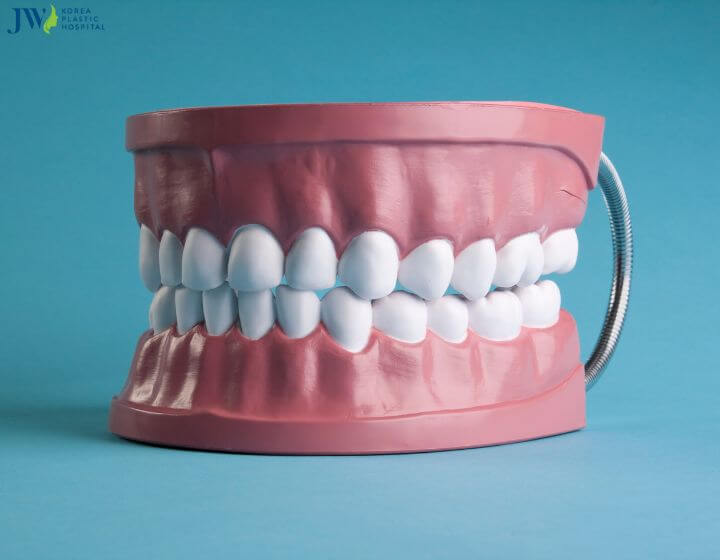 Răng sứ veneer có gây hại không? 2